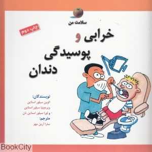 خرابی و پوسدگی دندان