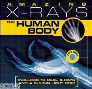 Amazing Xrays The Human Body