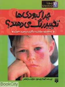 چرا کبودی‌ها تغییر رنگ میدهند (پاسخ به چراهای بدن)