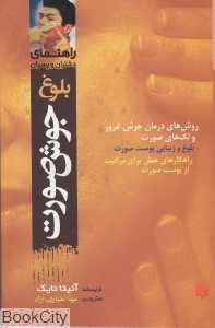 راهنمای دختران و پسران (بلوغ جوش صورت)
